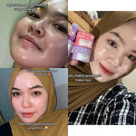 ADLEEVA - (Paket Pemula ISI 4) WHITENING Glow Booster / ACNE Bright Series Basic