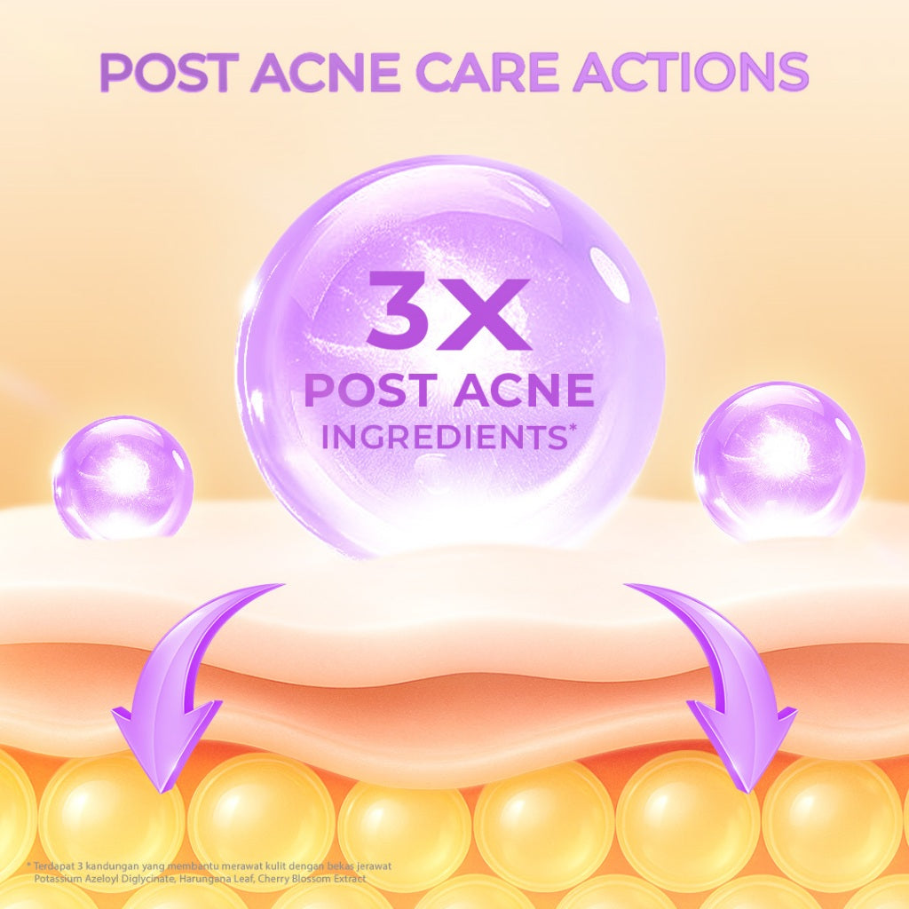 Hanasui Power Post Acne Serum - Pudarkan Bekas Jerawat PIE & PIH Mencerahkan dan Kurangi Kemerahan Cegah Jerawat Kembali