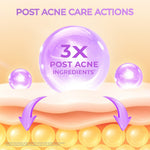 Hanasui Power Post Acne Serum - Pudarkan Bekas Jerawat PIE & PIH Mencerahkan dan Kurangi Kemerahan Cegah Jerawat Kembali