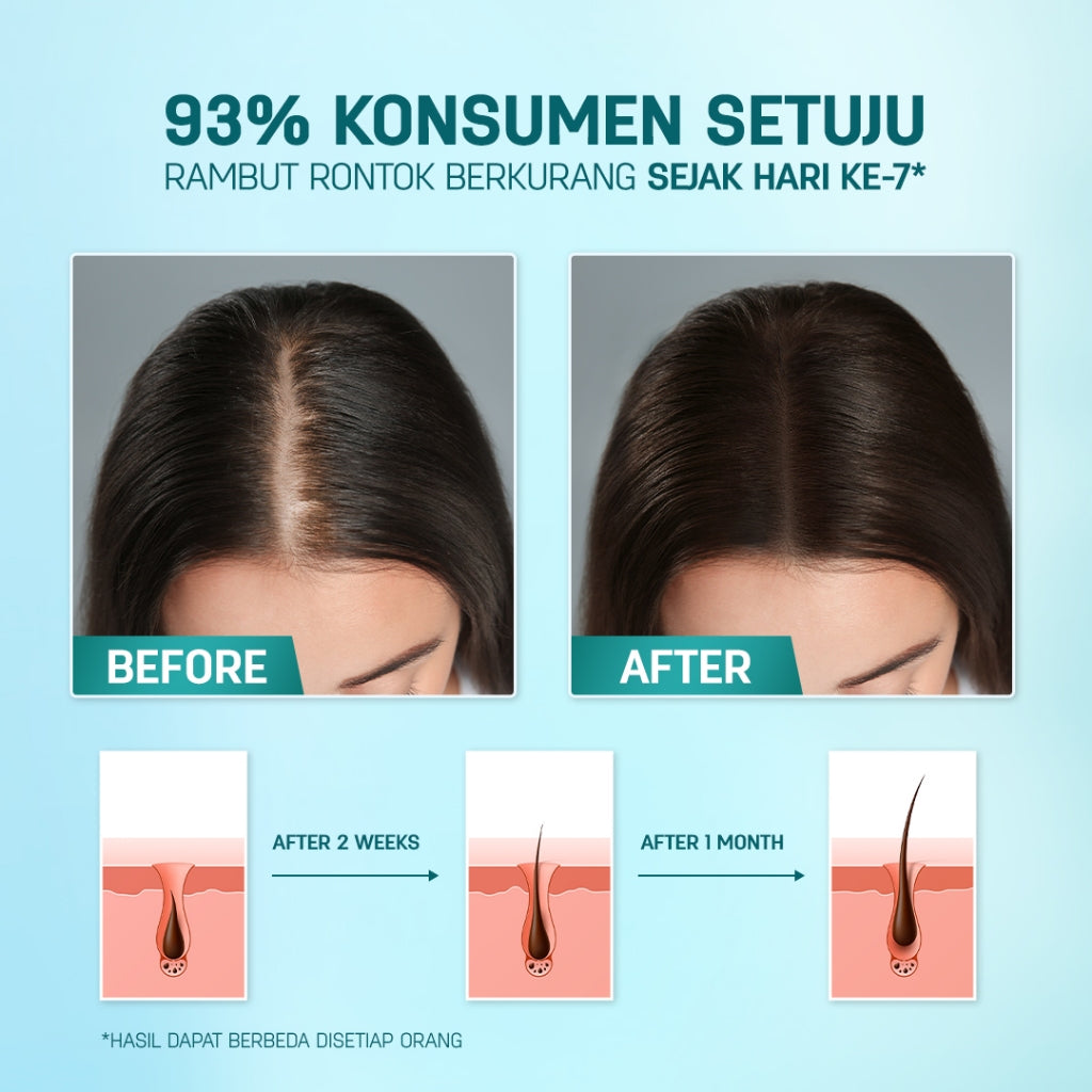 ERHAIR SET ANTI RONTOK Hairgrow Shampoo 370ml + Hair Tonic 60ml - Mencegah Rontok Hormonal | DHT Blocker | Panax Ginseng & Pumpkin Seed | Rekomendasi Ahli Dermatologi
