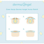 Derma Angel Patch Jerawat Pagi Original 6 pcs