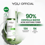 [NEW] YOU AcnePlus 5X Acid Toner Toner Acne Kulit Berminyak Berjerawat Obat Jerawat