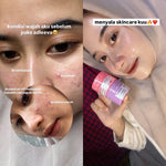 ADLEEVA Paket Hemat Acne Bright Series "COMPLETE" (Paket Isi 5 - Free Acne Blemish Spot)