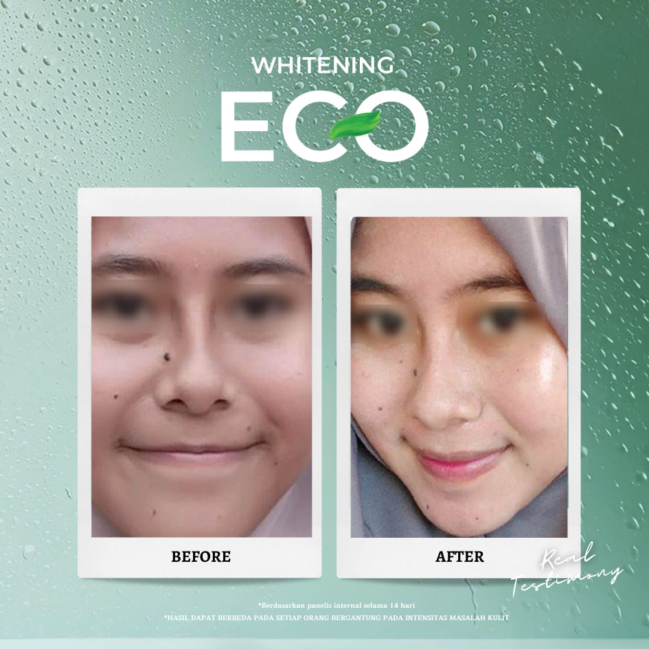 Personal Beauty Set Whitening Eco – Perawatan Wajah Cerah Glowing | Sabun Wajah + Day Cream + Night Cream | Mencerahkan 5x Lebih Cepat Dalam 14 Hari