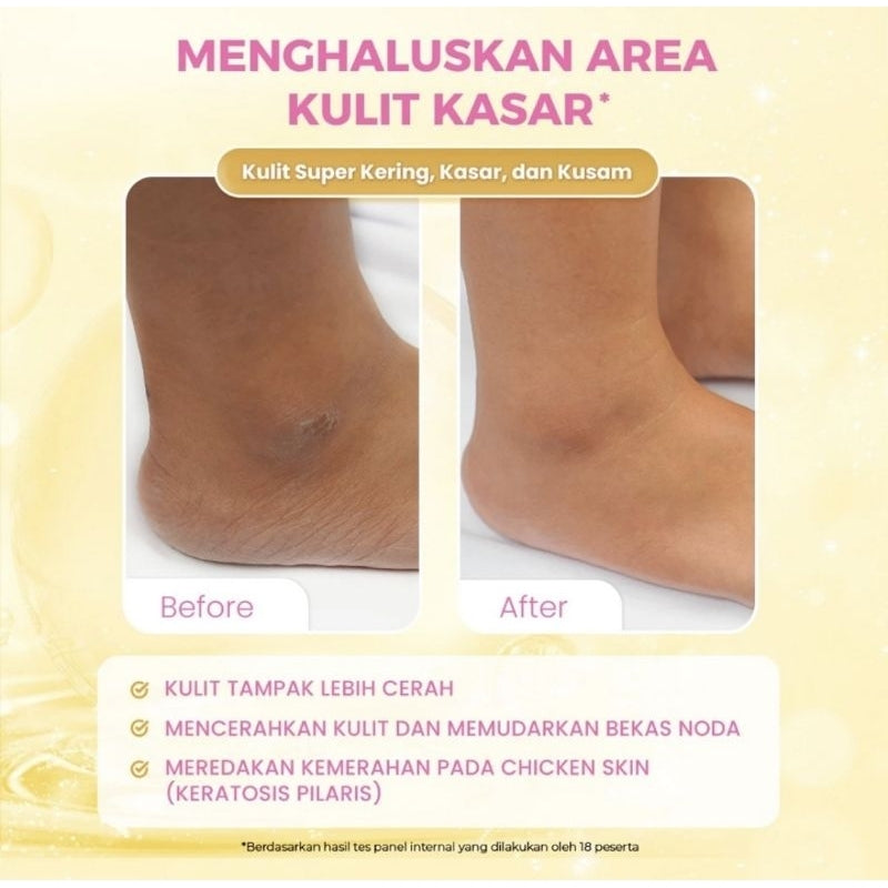 Scarlett Whitening Intense Brightening Serum Tubuh 5% AHA BHA PHA 120 mI