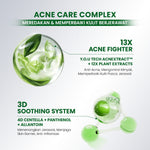 [NEW] YOU AcnePlus 5X Acid Toner Toner Acne Kulit Berminyak Berjerawat Obat Jerawat