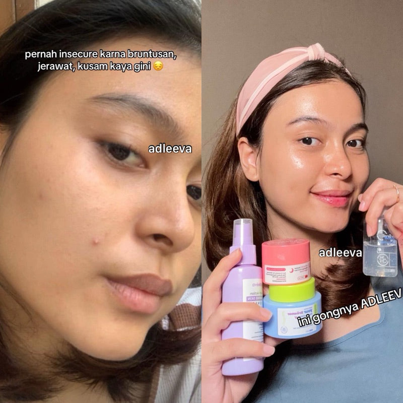 ADLEEVA Paket Hemat Whitening Glow Booster Series “COMPLETE” (Paket Isi 5)
