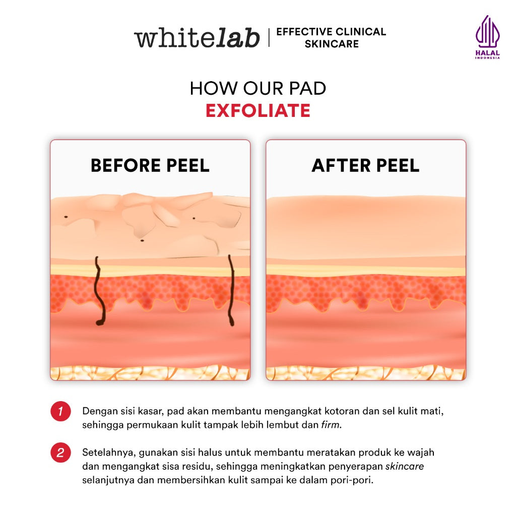 Whitelab Exfoliating Pads Peeling AHA BHA PHA - Pads Eksfoliasi Pengangkat Sel Kulit Mati Memperbaiki Tekstur Kulit & Komedo [BPOM]