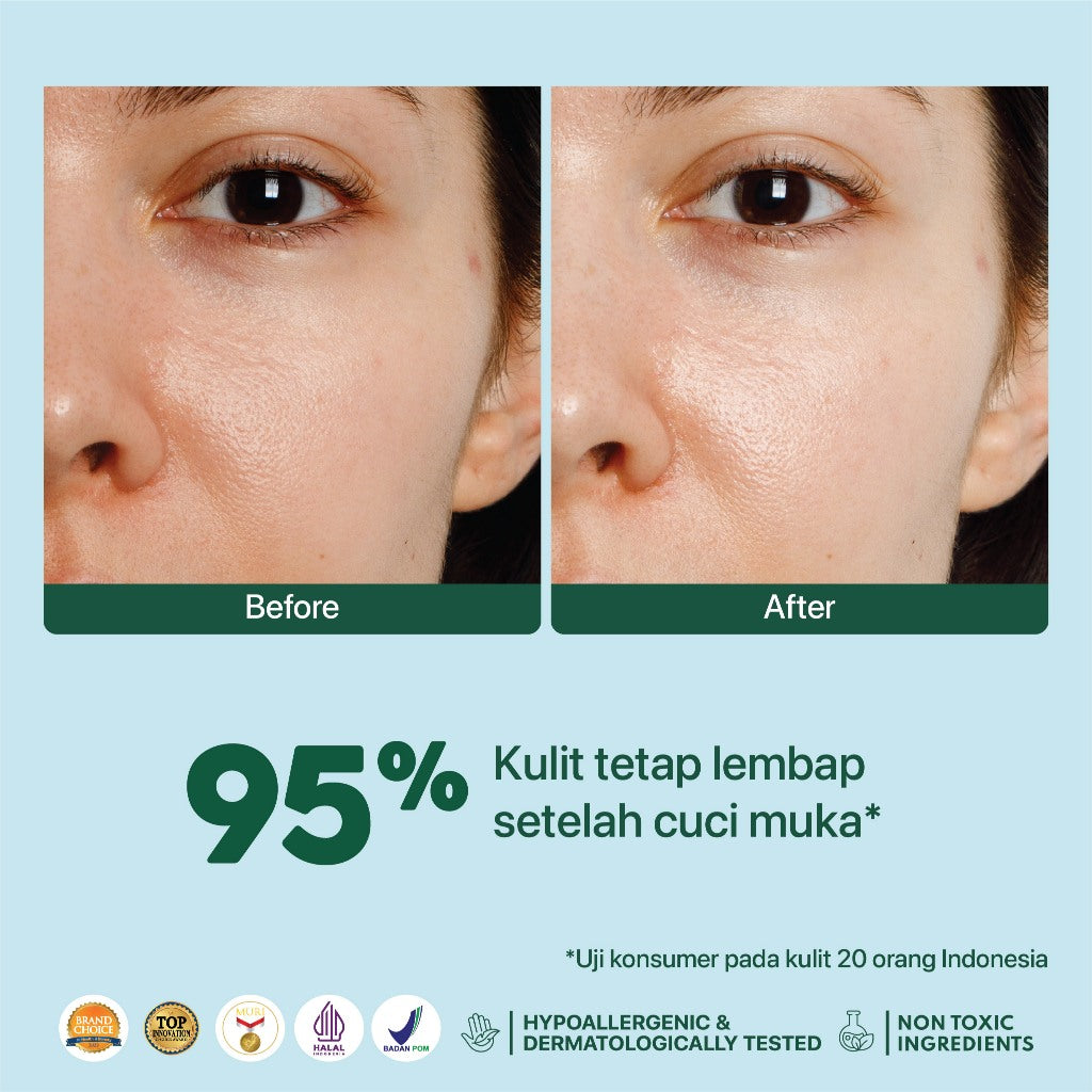 CICA FACE WASH - NPURE Facial Wash Cica / Anti Acne Facial Foam / Sabun Muka Anti Jerawat Berminyak