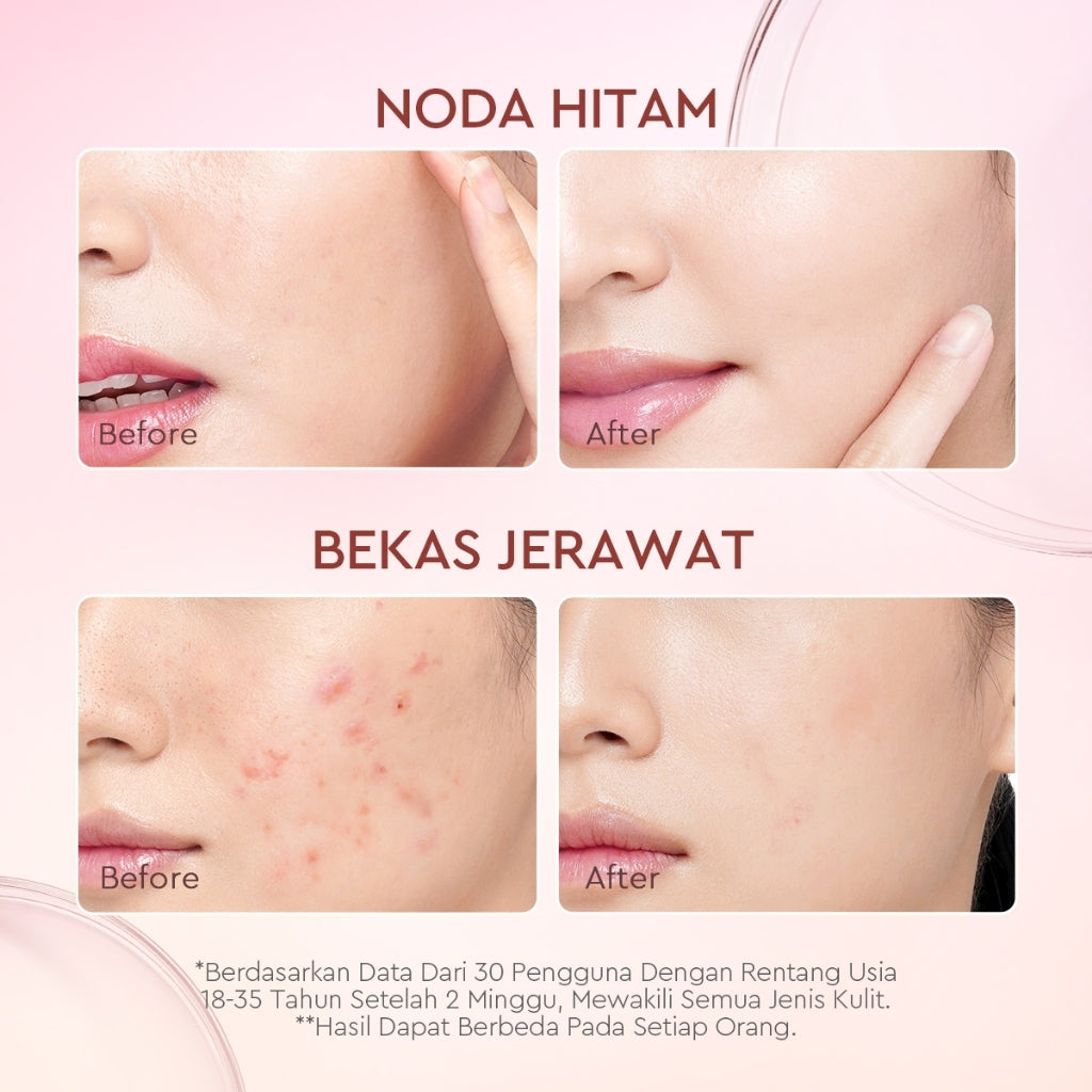 Glad2Glow Pomegrante Niacinamide Power Bright Serum Brightening Serum Mencerahkan Wajah Pemutih Wajah Serum Wajah Serum Glowing Serum Whitening Serum And Essence Wajah Facial Serum Niacinamide Serum Lightening Serum G2G Serum Bekas Jerawat Serum Wajah