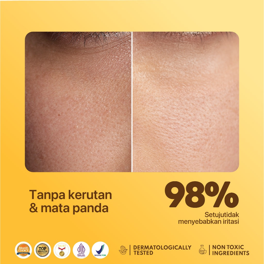 EYE SERUM - NPURE Eye Serum / Marigold / Eyemazing Power Serum Concentrate/ Krim Mata / Anti Mata Hitam Panda / Kantong Mata