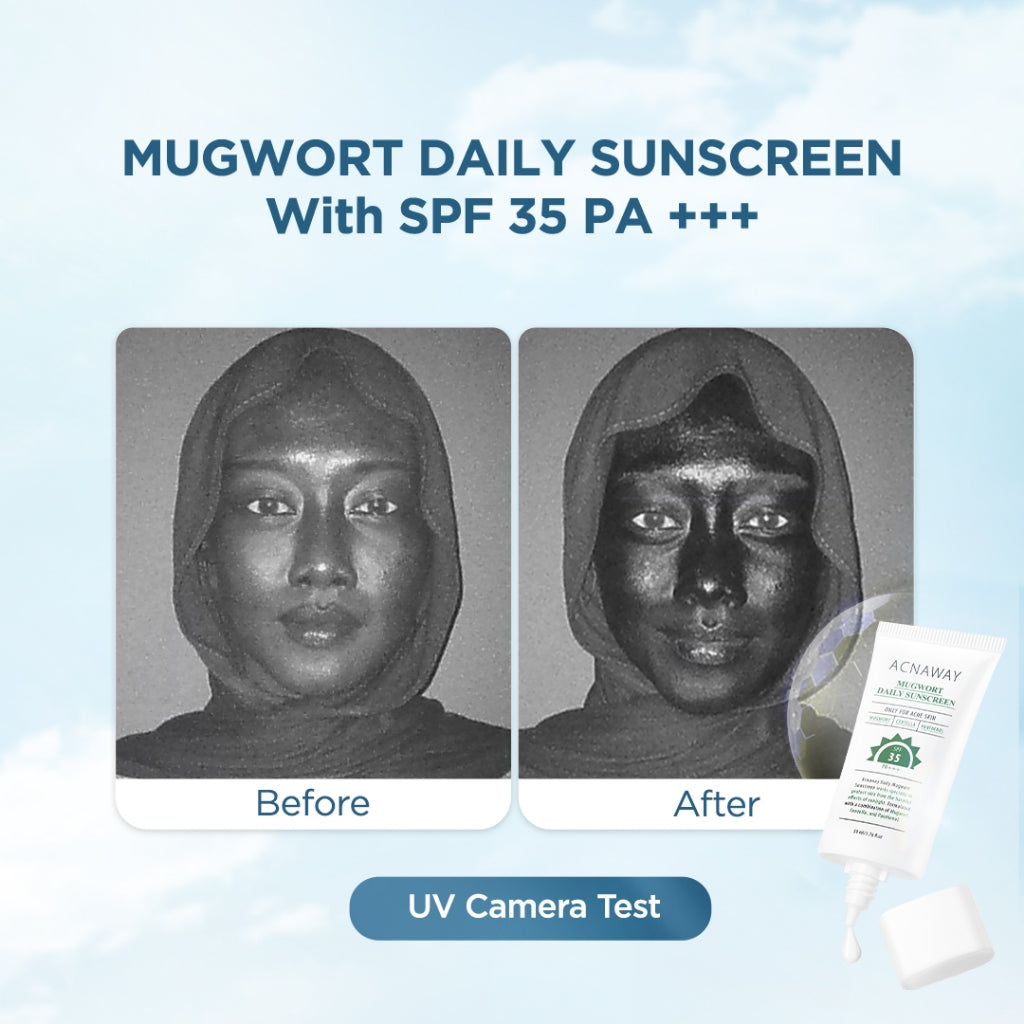 ACNAWAY Mugwort Daily Sunscreen SPF 35 PA+++ – Sunscreen Wajah Ringan UV Protection Lightweight No Whitecase No Comedogenic Acne Calming Tabir Surya Cepat Menyerap untuk Kulit Berjerawat Melembapkan & Melindungi Kulit Berjerawat Cocok Semua Jenis Kulit