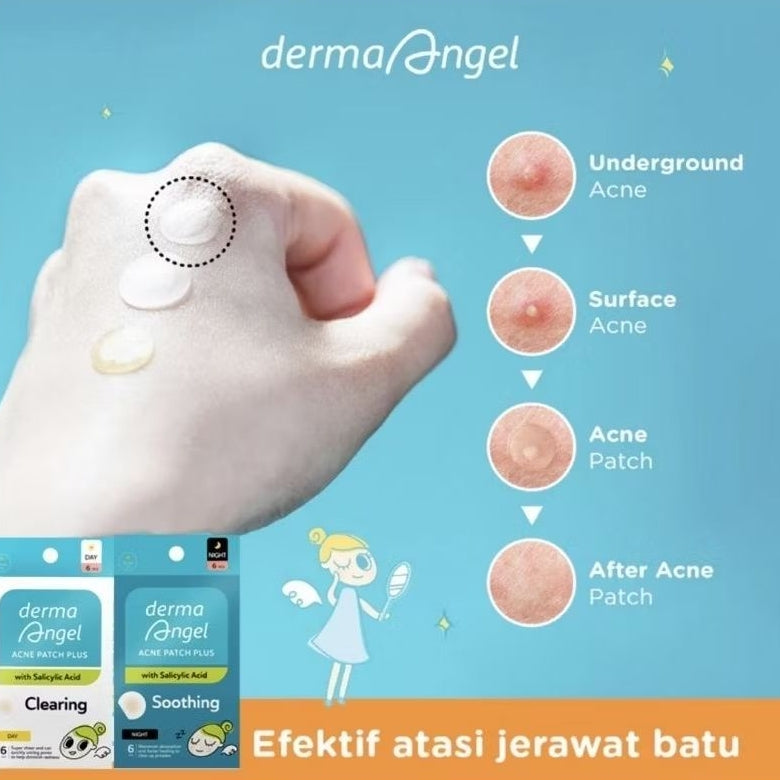 Derma Angel Patch Jerawat Salicylic Acid Malam 6 pcs