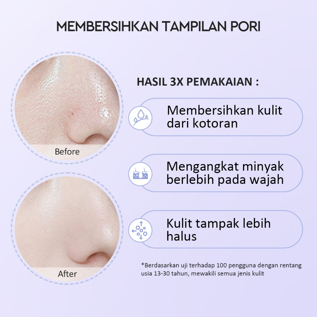 Glad2Glow Volcano 3D Acid Pore Clay Stick Masker Wajah Clay Masker Stik Deep Cleansing Pori Pori Masker Komedo Dan Pori Pori Wajah Pembersih Komedo clay Masker Masker Organik Masker Jerawat Sheetmask Masker Glad2Glow Clay Mask Masker G2Glow Official Store