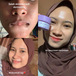 ADLEEVA - BUNDLE Basic Skincare Kit (Isi 3 produk)