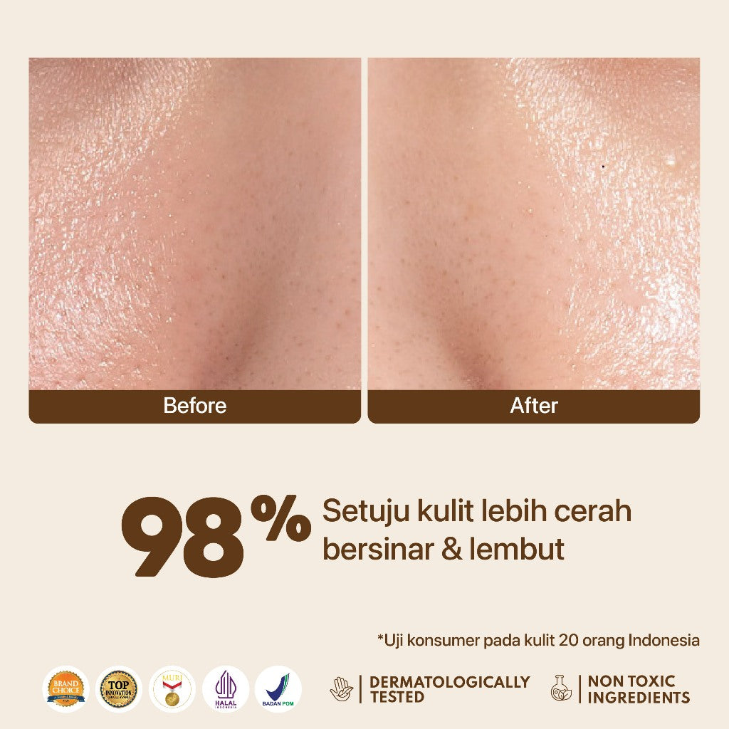 NPURE Bundling Licorice Serum + Licorice Moisturizer 30gr / Bright and Glow / Rangkaian Skincare / Mencerahkan