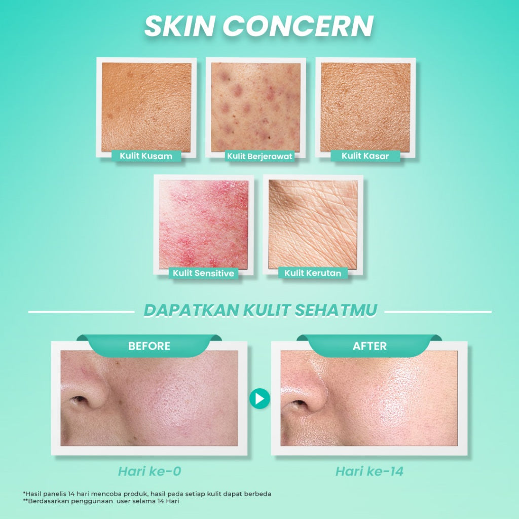 Hanasui Ceramide Probiotics Moisturizer Gel - Pelembab Ringan Lembap Perbaiki Skin Barrier dan Mencerahkan