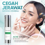 MS glow ACNE Serum