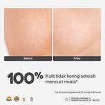 NPURE Cleanser Gel Noni 100ml / Sabun Muka Kulit Sensitif / Gentle Skin Cleanser / Pembersih Wajah Hypoallergenic / Eksim / Eczema / Semua Jenis Kulit