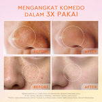 Glad2Glow Yuzu Aha Blackhead Exfoliating Cleanser facial wash skincare face wash sabun cuci muka cleansing balm exfoliating exfoliasi wajah sabun muka pembersih wajah Yuzu Aha Blackhead Exfoliating Cleanser Eksfoliasi secara lembut g2glow official store