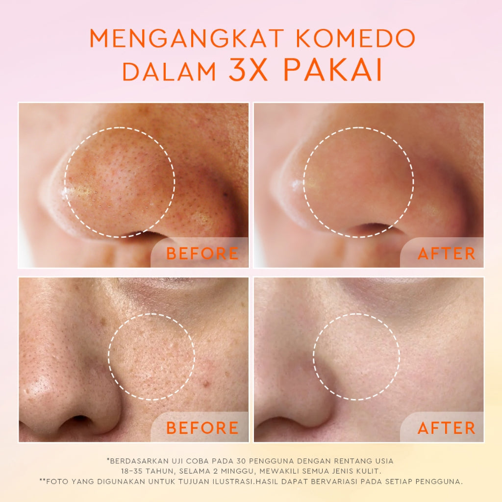 Glad2Glow Yuzu Aha Blackhead Exfoliating Cleanser facial wash skincare face wash sabun cuci muka cleansing balm exfoliating exfoliasi wajah sabun muka pembersih wajah Yuzu Aha Blackhead Exfoliating Cleanser Eksfoliasi secara lembut g2glow official store