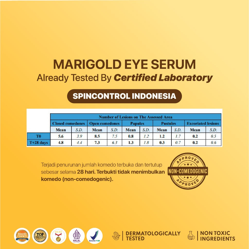 NPURE Eye Serum / Marigold / Eyemazing Power Serum Concentrate/ Krim Mata / Anti Mata Hitam Panda / Kantong Mata