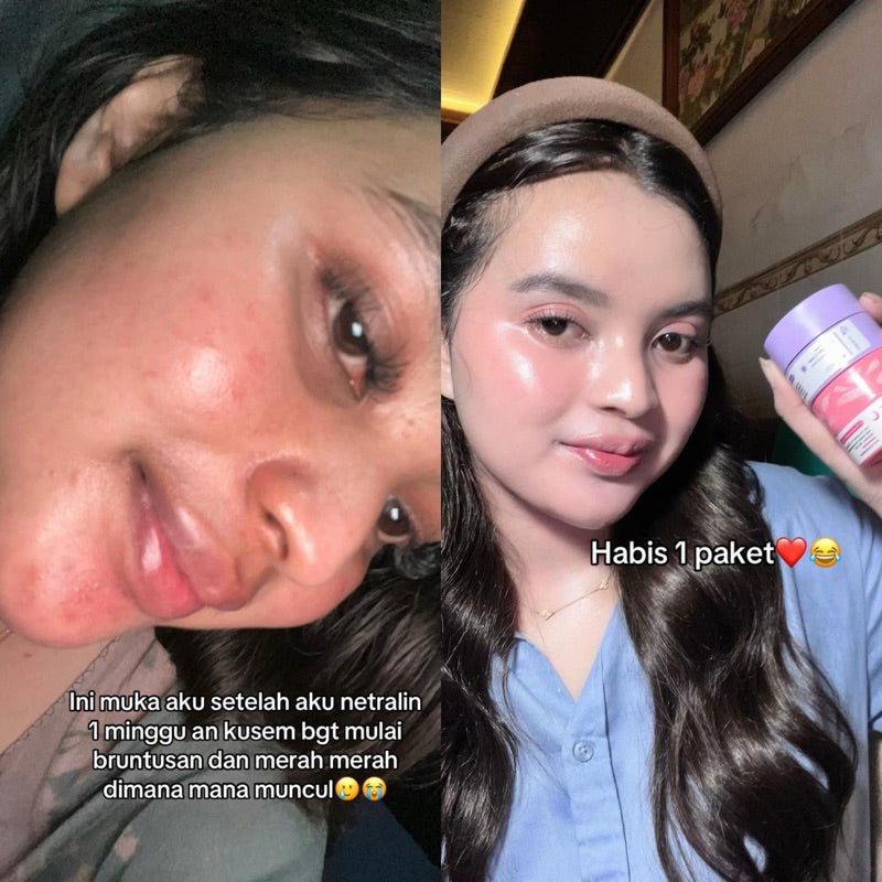 ADLEEVA Paket Hemat Whitening Glow Booster Series “COMPLETE” (Paket Isi 5)
