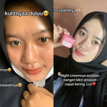 ADLEEVA Paket Hemat Acne Bright Series "COMPLETE" (Paket Isi 5 - Free Acne Blemish Spot)