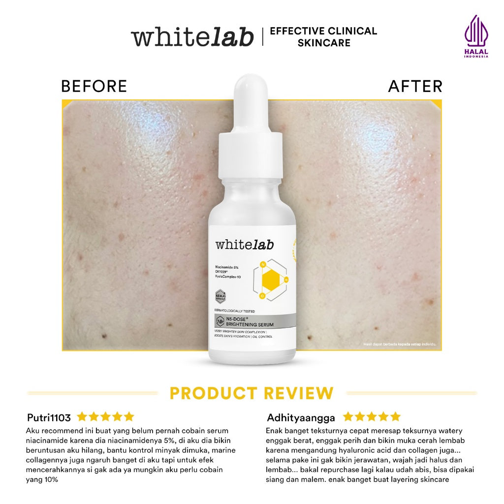 Whitelab Serum Niacinamide 5% Brightening Booster - Cerah Maksimal untuk Kulit Sensitif N5-Dose+ 2.0