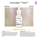 Whitelab Serum Niacinamide 5% Brightening Booster - Cerah Maksimal untuk Kulit Sensitif N5-Dose+ 2.0
