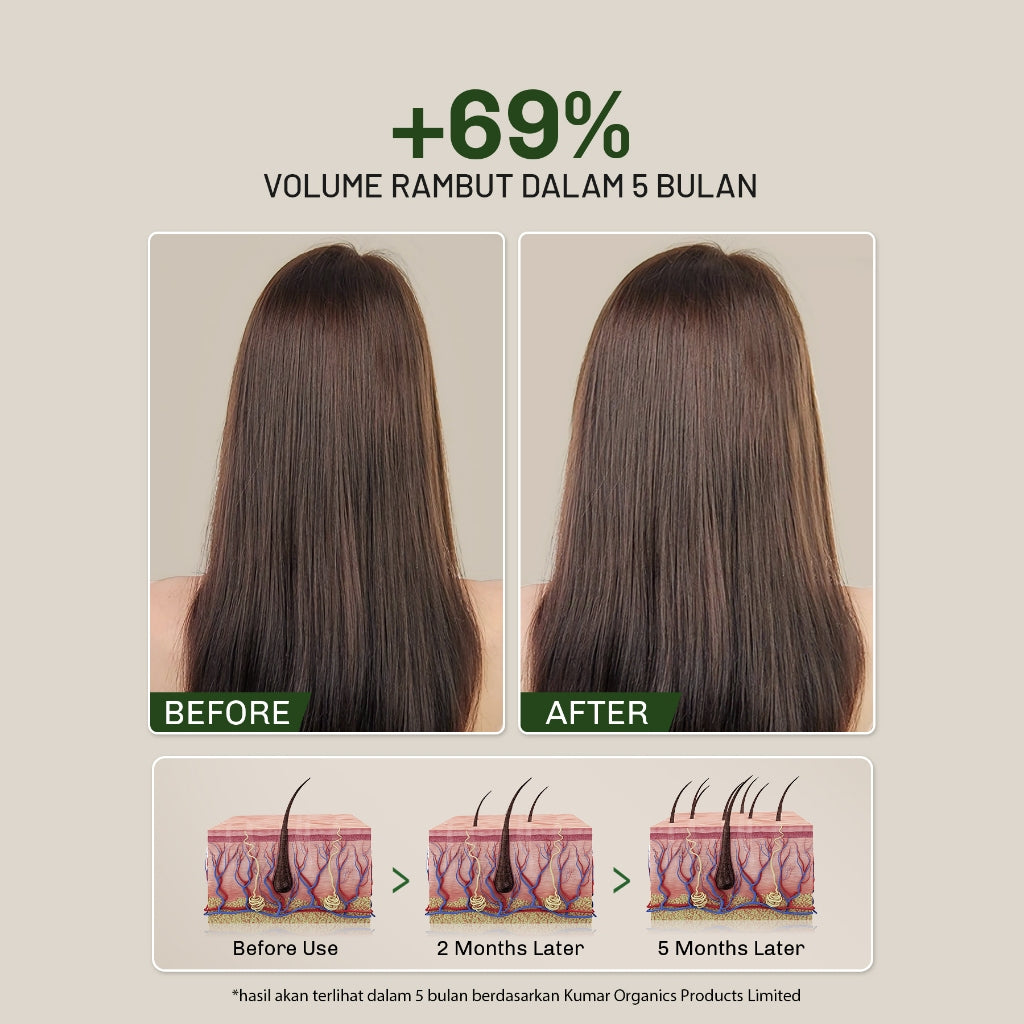 [LIVE] Lavojoy Hold Me Tight Pro Shampoo Spring Wonder Hair Fall Care | Hair Shampoo | Sampo Rambut | Shampoo Perawatan Rambut Rontok | Mempercepat Pertumbuhan Rambut | Mengurangi Kerontokkan | Sampo Ginseng & Jahe