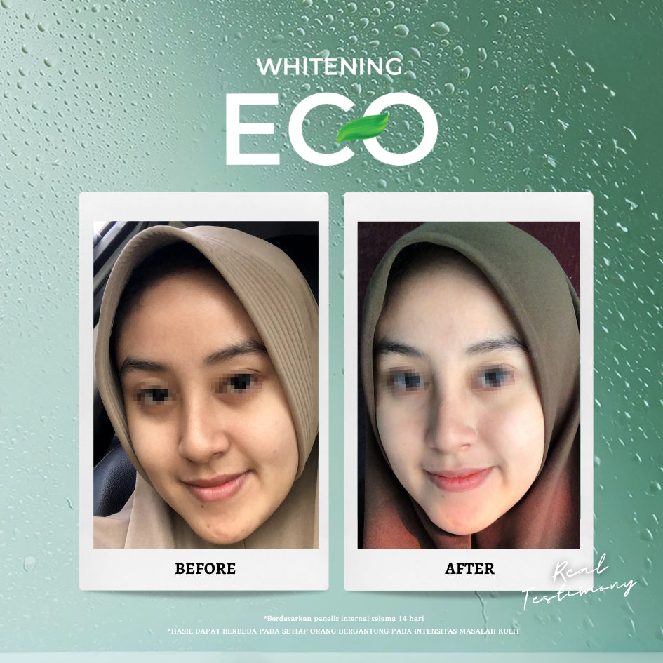 Personal Beauty Set Whitening Eco – Perawatan Wajah Cerah Glowing | Sabun Wajah + Day Cream + Night Cream | Mencerahkan 5x Lebih Cepat Dalam 14 Hari