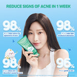 SENKA Perfect Whip Acne Care Facial Foam 100gr [FS]