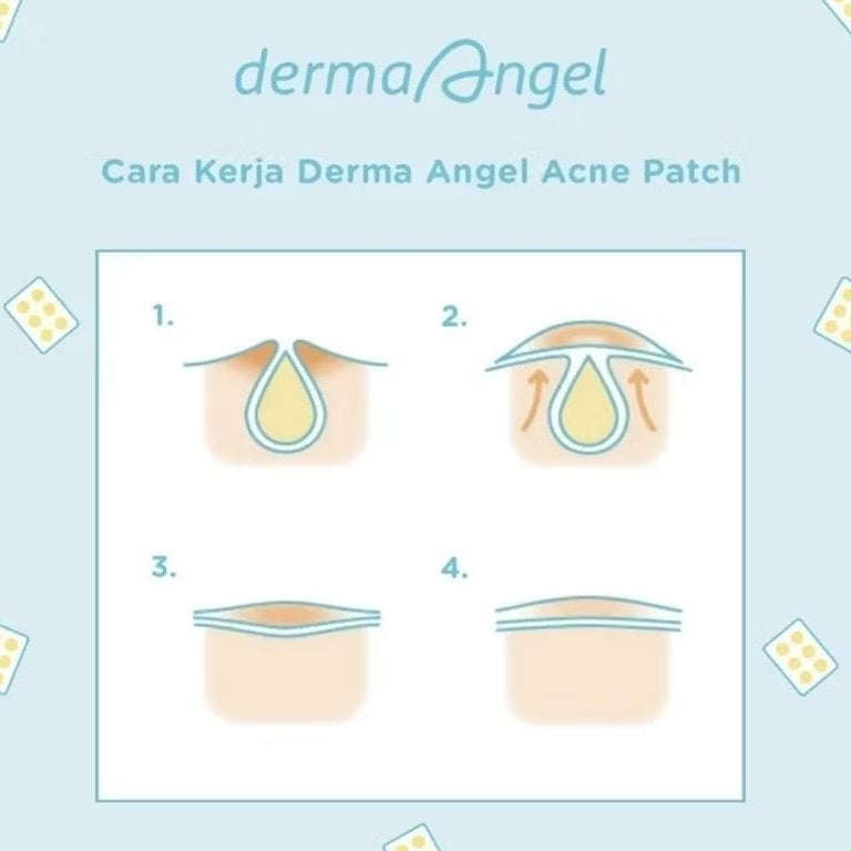 Derma Angel Patch Jerawat Malam 6 pcs