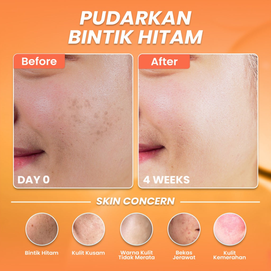 Hanasui Serum Vitamin C - Mencerahkan & Pudarkan Bintik Hitam 2% Vitamin C 2% Niacinamide 1% Betaine