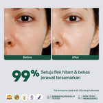 DARK SPOT - NPURE Spot Treatment Dark Spot / Menyamarkan noda hitam bekas jerawat