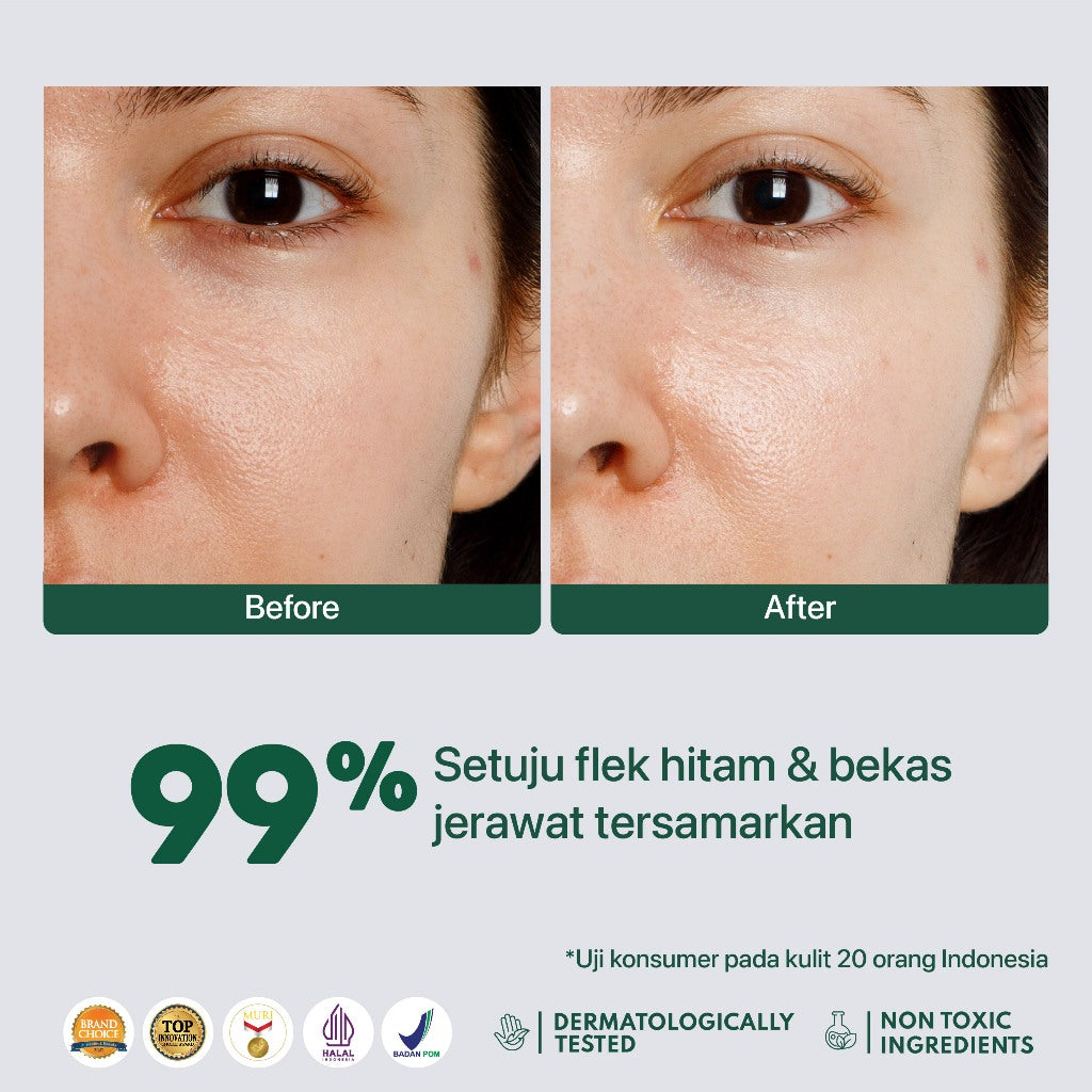 DARK SPOT - NPURE Spot Treatment Dark Spot / Menyamarkan noda hitam bekas jerawat