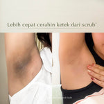 MOSSÈRU 3% Tranexamic Bright Booster Serum | Tranexamic Acid | Niacinamide | Brightening Serum | Menenangkan kulit Kemerahan | Pudarkan Flek & Melasma  | Serum Bekas Jerawat | Menghidrasi kulit | Meratakan warna kulit | Memudarkan bekas je