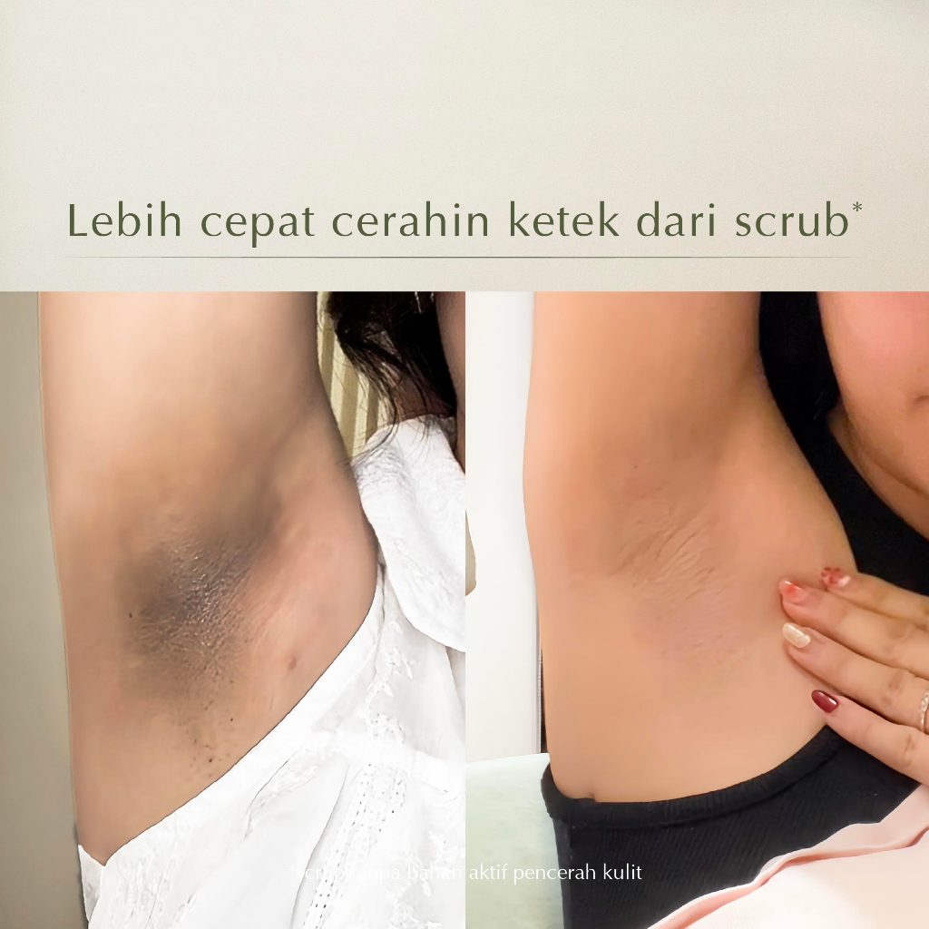MOSSÈRU 3% Tranexamic Bright Booster Serum | Tranexamic Acid | Niacinamide | Brightening Serum | Menenangkan kulit Kemerahan | Pudarkan Flek & Melasma  | Serum Bekas Jerawat | Menghidrasi kulit | Meratakan warna kulit | Memudarkan bekas je