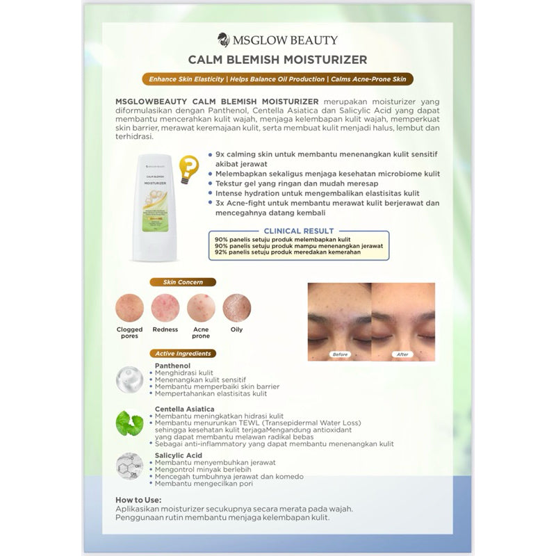 MS Glow Acne Moisturizer / Calm Blemish Moisturizer