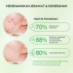 Glad2Glow Masker Wajah Clay Anti Jerawat Mugwort Stik 25 g