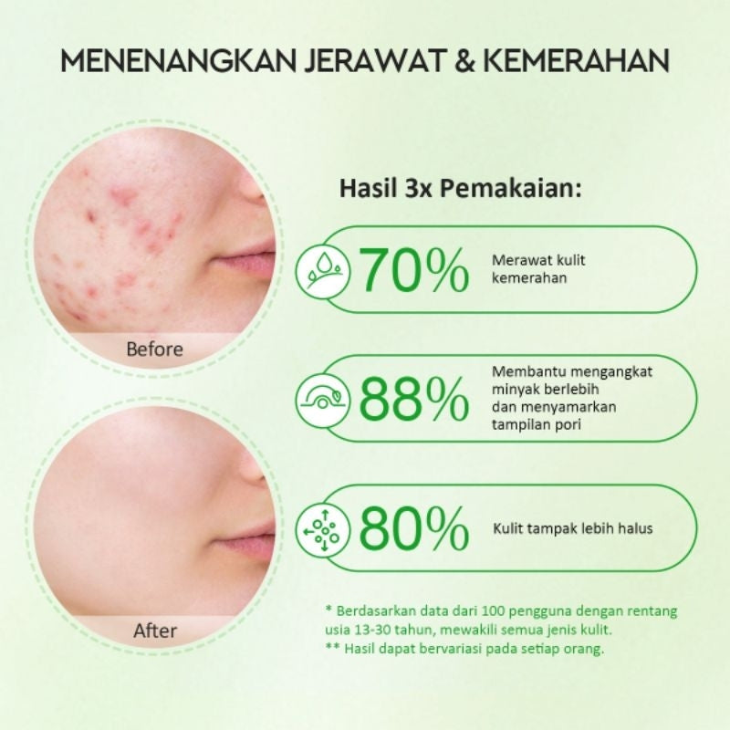 Glad2Glow Masker Wajah Clay Anti Jerawat Mugwort Stik 25 g