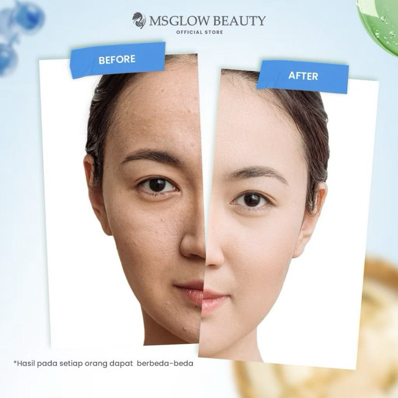 MS GLOW SUN WHITE PRE & PROBIOTIC SUN SCREEN SPF50