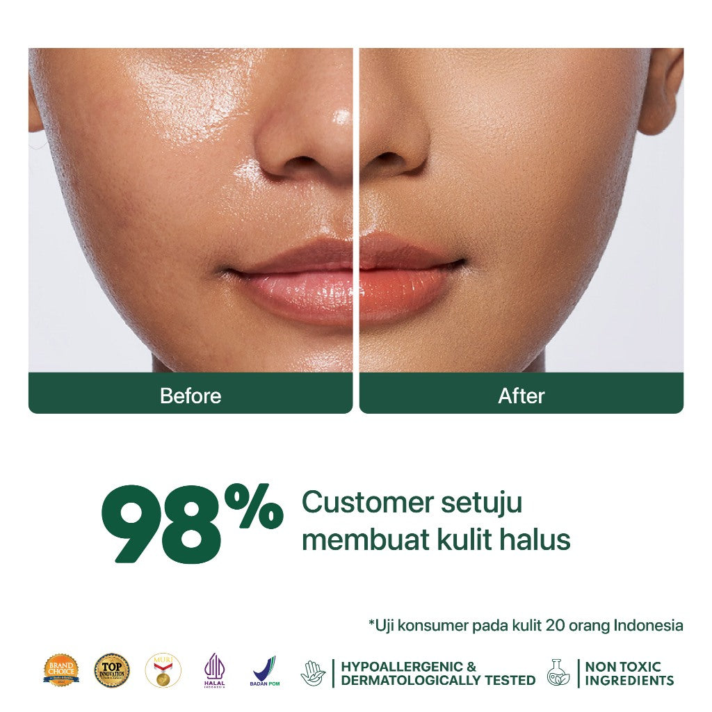 NEW BUNDLE - NPURE Acne Power Cover Power Powder + Power Glow Lip Oil / Set Makeup / Daily Use / Makeup Harian / Makeup Lebaran / Untuk Semua Jenis Kulit