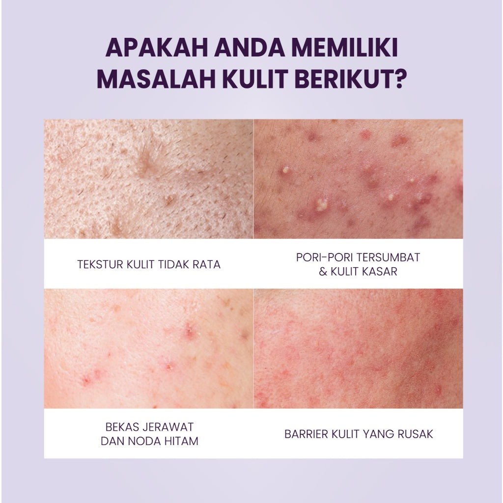 YOU Retinol 2pcs Set Advanced Retinol Serum 15ml + Renewal Retinol Moisturizer Anti aging Retinol Paket kulit cerah Brightening Dark spot noda hitam Memperbaiki tekstur kulit Anti aging Menyamarkan mencegah kerutan dan garis halus