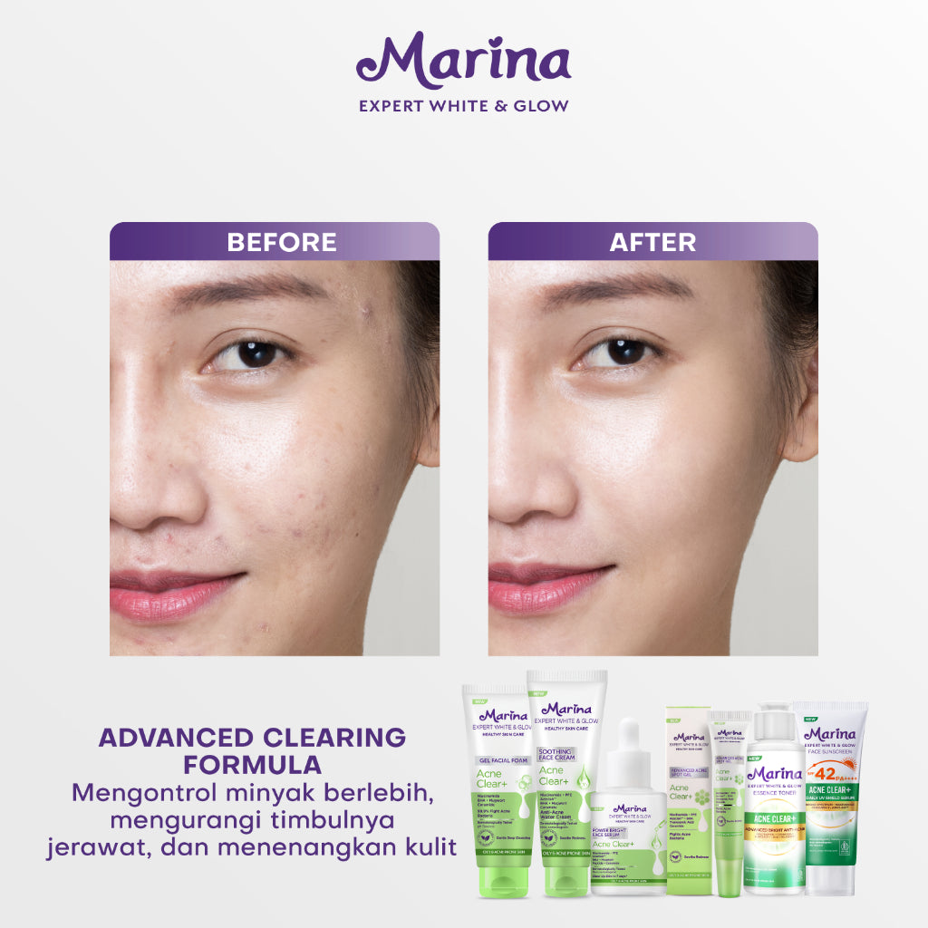 Marina Expert White & Glow Power Bright Face Serum – Acne Clear+ - Exp : 01.2026