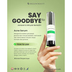 MS glow ACNE Serum