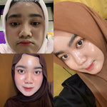 ADLEEVA - (Paket Pemula ISI 4) WHITENING Glow Booster / ACNE Bright Series Basic