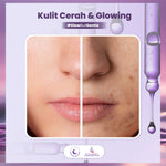 ADLEEVA Glow-Fusion Overnight PEELING SOLUTION - Serum Eksfoliasi