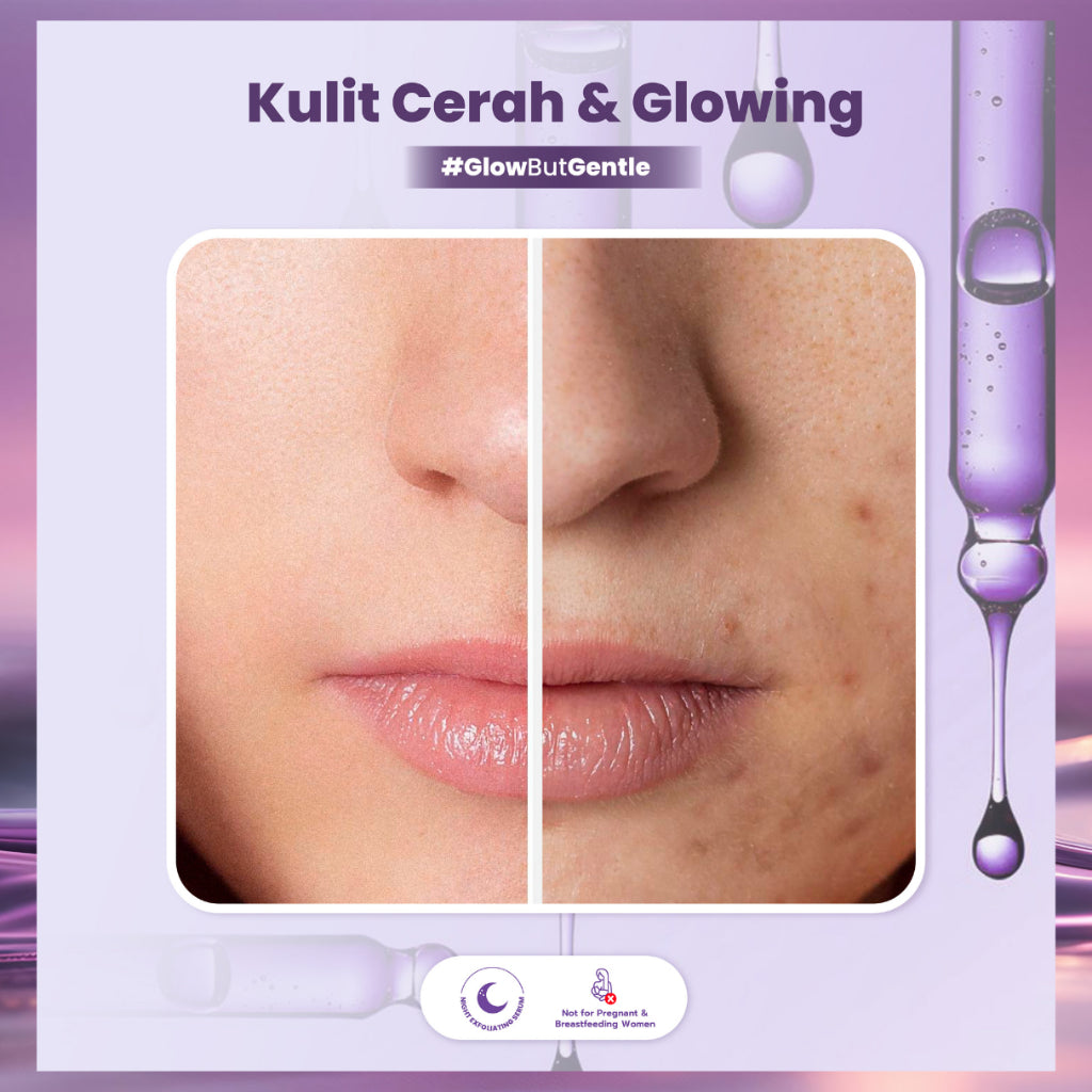 ADLEEVA Glow-Fusion Overnight PEELING SOLUTION - Serum Eksfoliasi